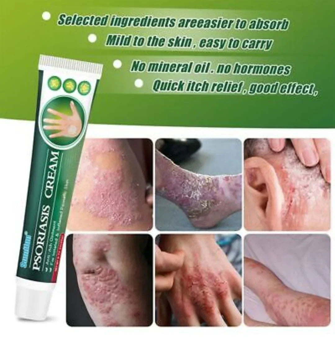 Psoriasis Cream (Original) ā 20g